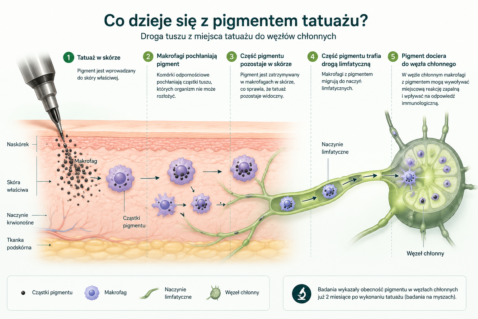 Schemat drogi pigmentu tatuażowego ze skóry przez naczynia limfatyczne do węzła chłonnego i udziału makrofagów