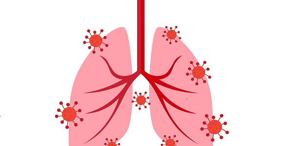 Jak leczyć oskrzela?