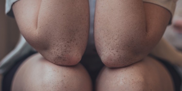 Jakie zioła na odbudowę chrząstki stawowej?